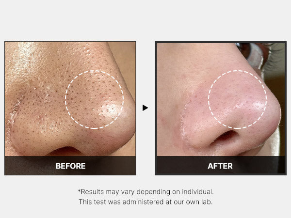 Medicube One Day Exosome Shot (Pores)