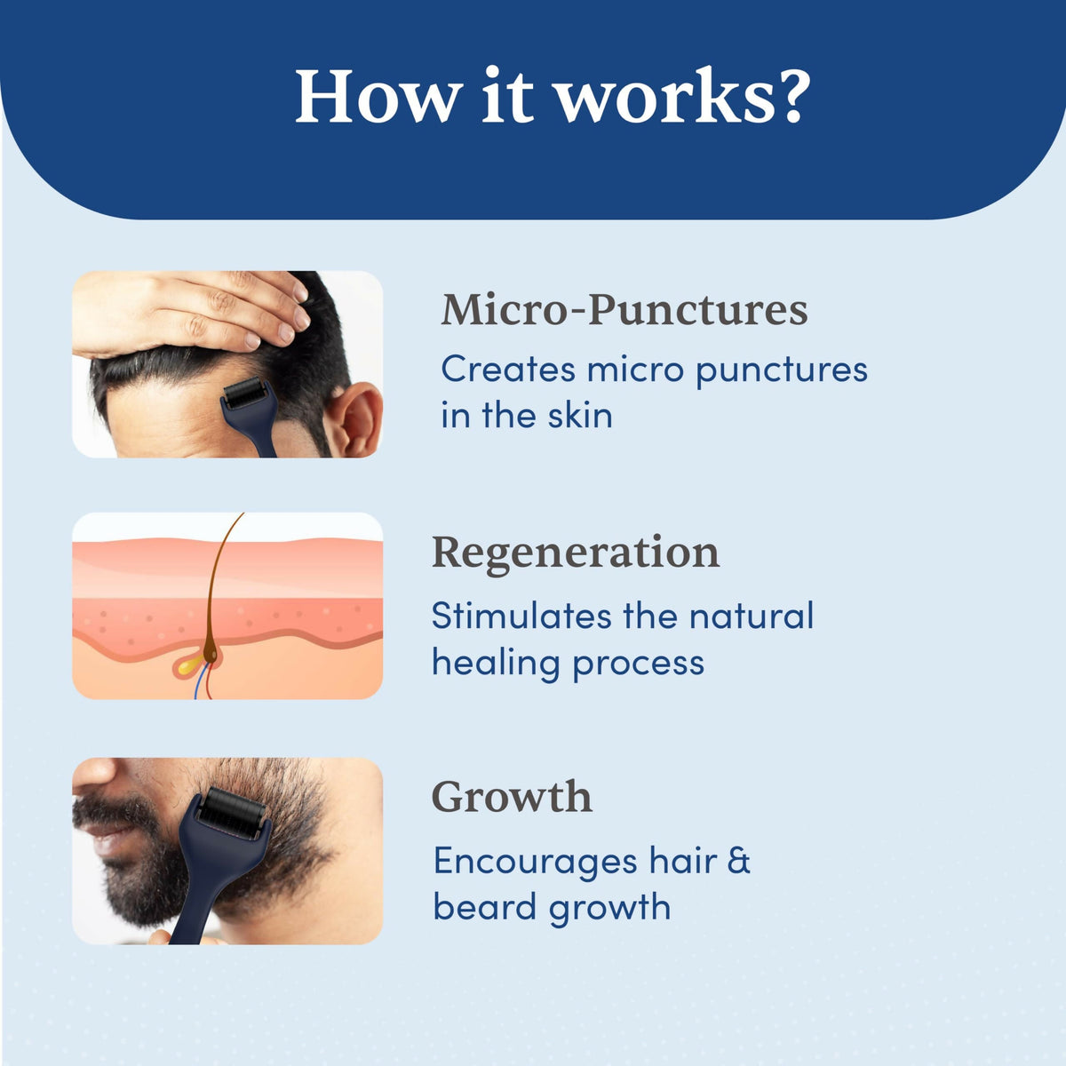 Man Matters Advance Derma Roller For Hair & Beard - 540 Micro 0.5mm Titanium Alloy Needles